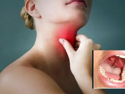 Cần làm gì khi bị hóc xương?